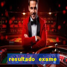 resultado exame eliel figueiredo